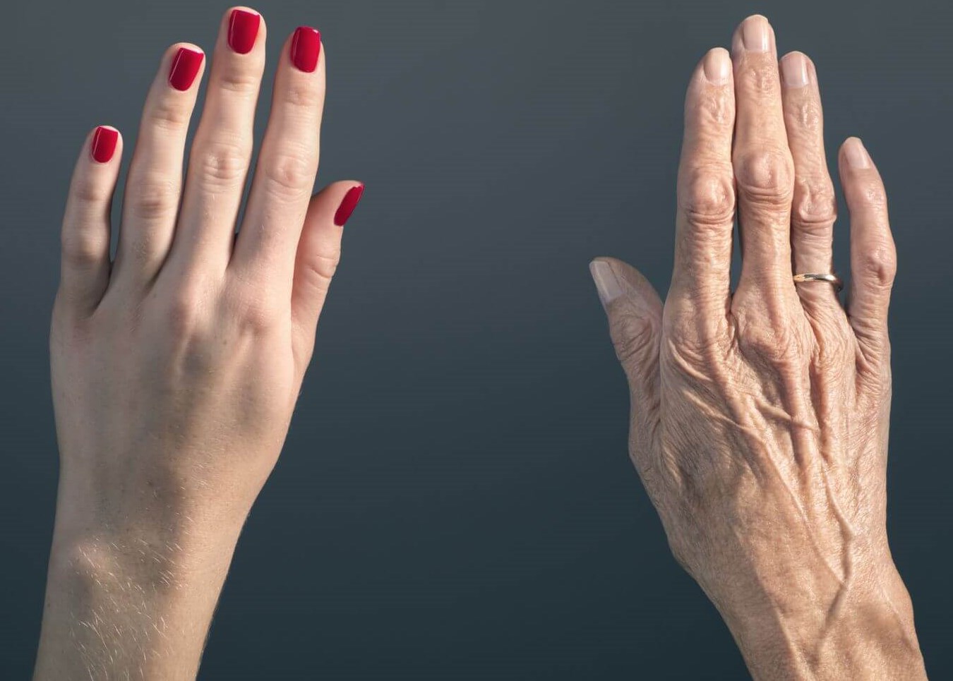 aging hands