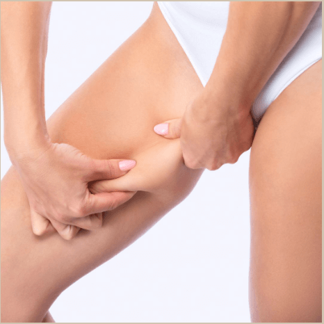thigh surgery